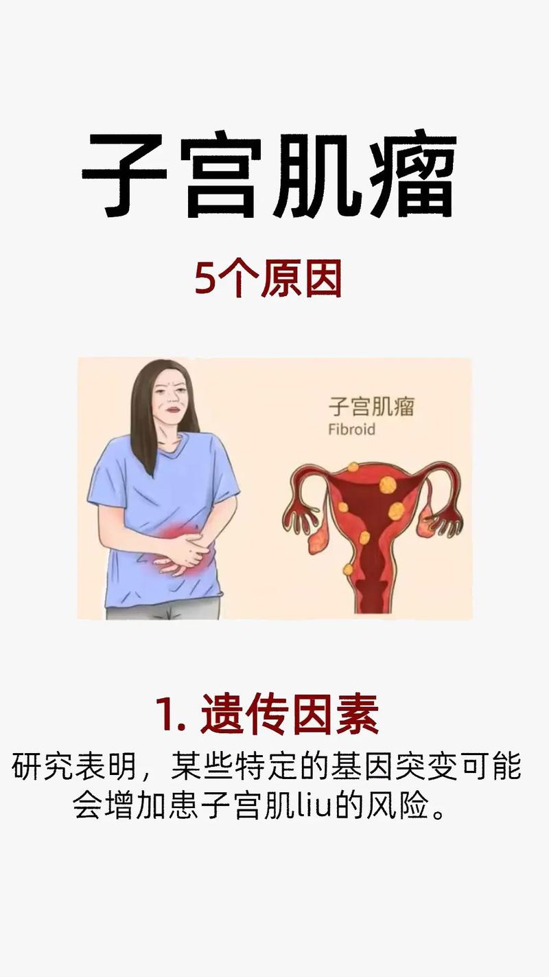 女性子宫长瘤子是什么引起的,女性子宫长瘤子是什么引起的怎么治疗