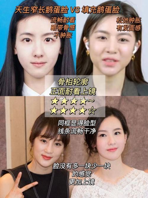 陈都灵对比照,陈都灵长得像谁