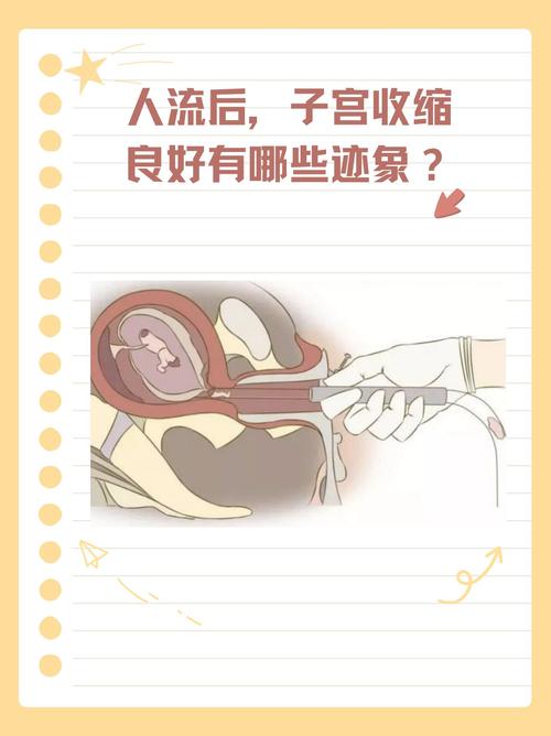 40岁人流后应该注意什么,40岁做完人流后多久能恢复