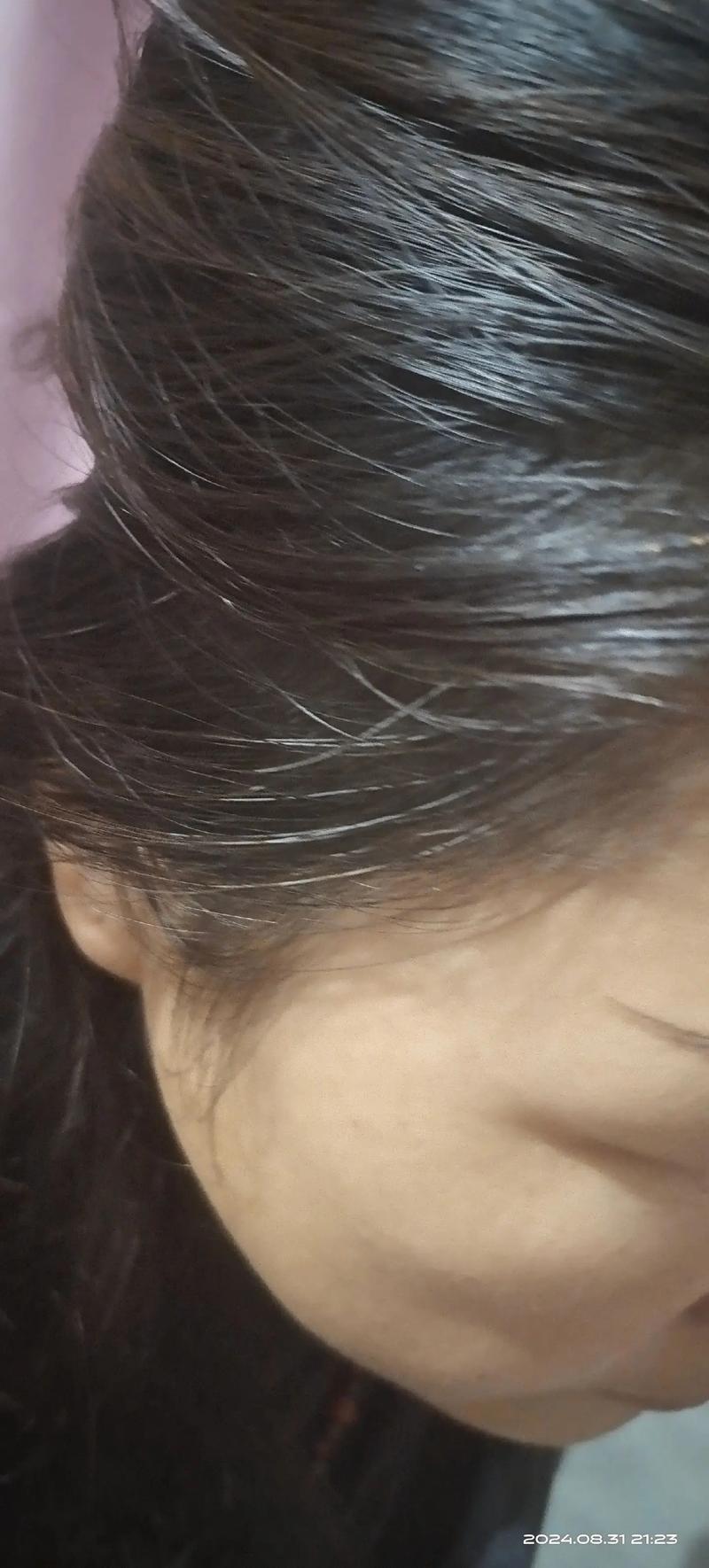 气血足了,白发能黑吗,气血不足改善后白发会变黑吗