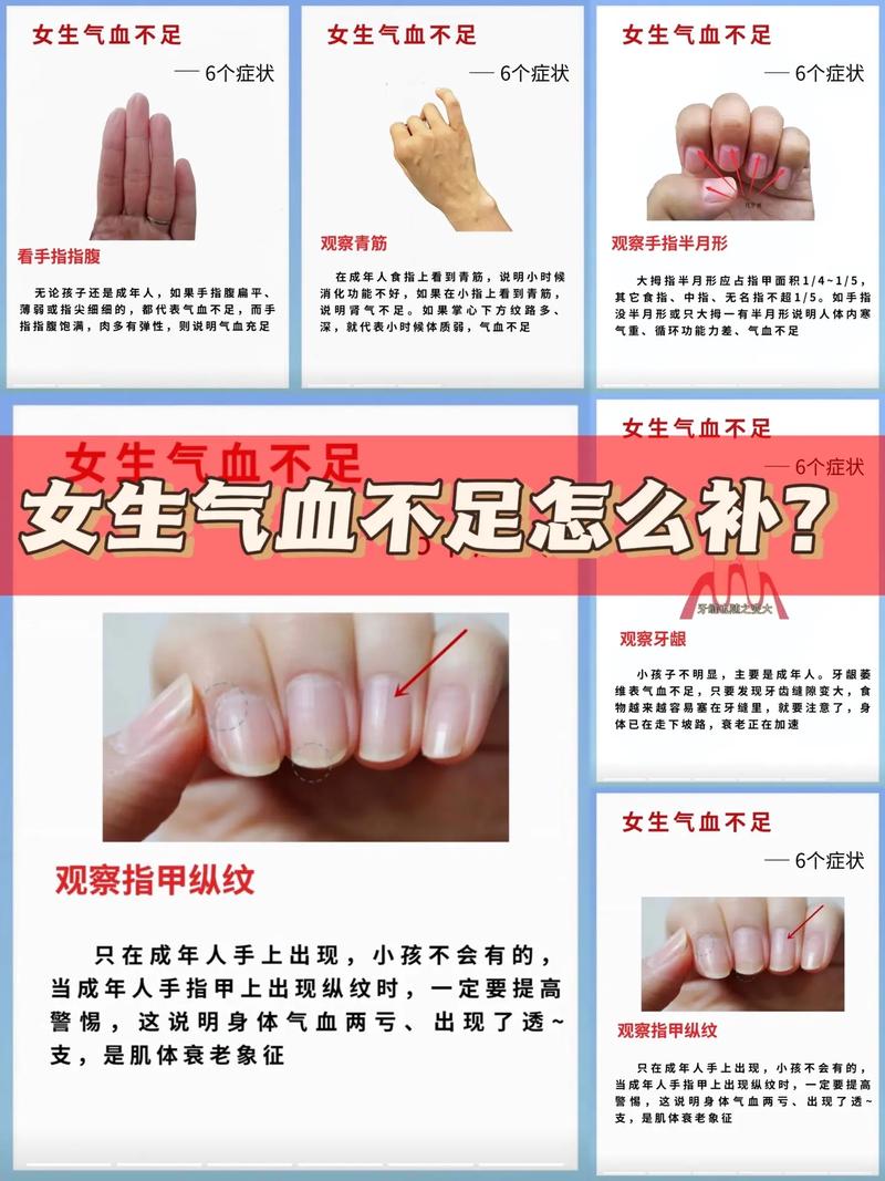 女人气血不足的三种表现,女人气血不足的三种表现有哪些
