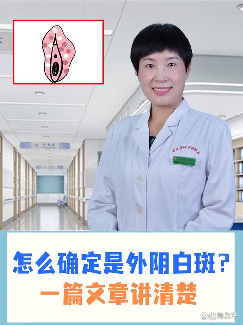 什么是妇科白斑有什么症状呢:妇科白斑病是一种什么病怎样治疗
